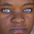 What Determines Eye Color?