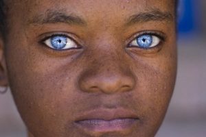 What Determines Eye Color?
