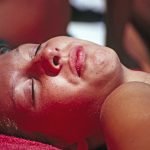How to get rid of a sunburn’s peeling skin
