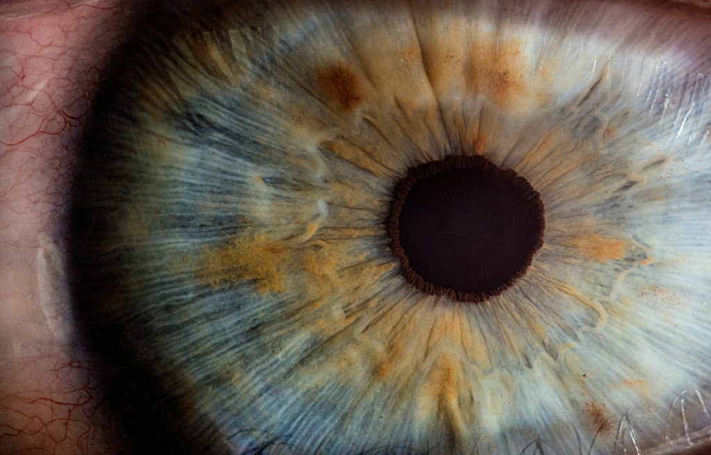 How Can Diet Prevent Cataracts and Enhance Eye Health? 1 How Can Diet Prevent Cataracts and Enhance Eye Health?