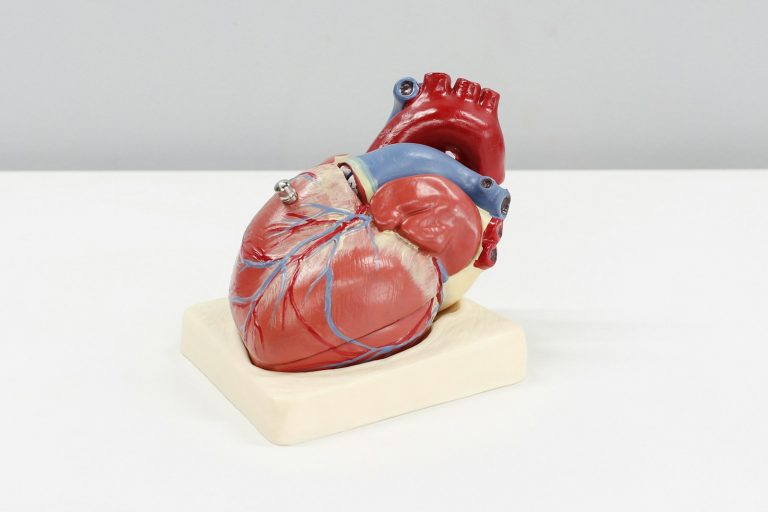 What is the difference between a heart attack and cardiac arrest?