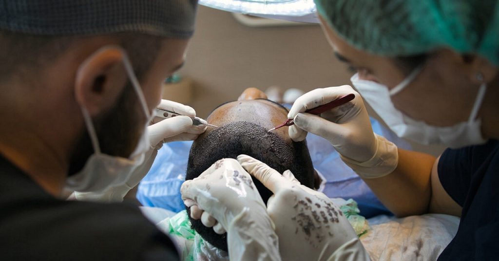 10 Pre-Transplant Considerations for Optimal Hair Growth
