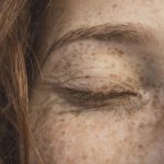 Genetic and Environmental Secrets Behind Freckles: Why They Form on Your Skin