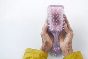 How your genetics affect the result of your hair transplant
