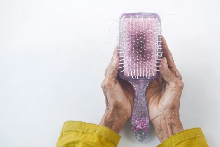 How your genetics affect the result of your hair transplant