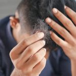 12 Common Causes of Hair Loss in Men and Women