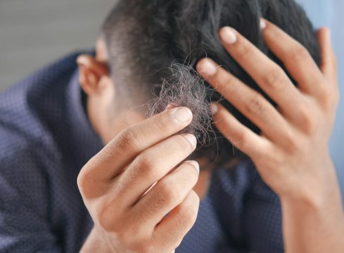 a man is combing his hair with his hands
