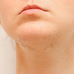Why Do Some Women Grow a Beard?