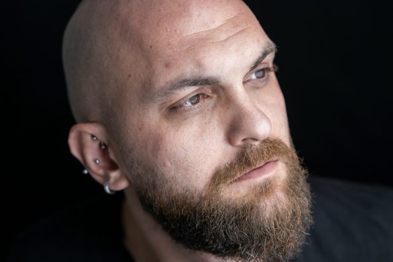 Are Bald Men More Attractive Than Men with Hair?