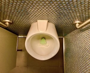 Why Does My Pee Look Red?