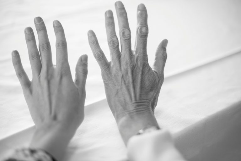 Why Do Fingers Wrinkle in Water? Understanding the Biological Response of the Skin to Prolonged Water Exposure