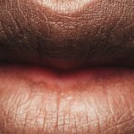 What Causes Dry Mouth?