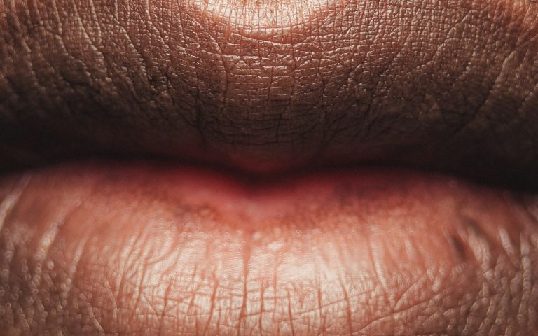 What Causes Dry Mouth?