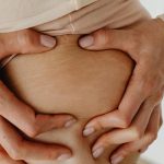 How to Get Rid of Stretch Marks… Or Prevent Them