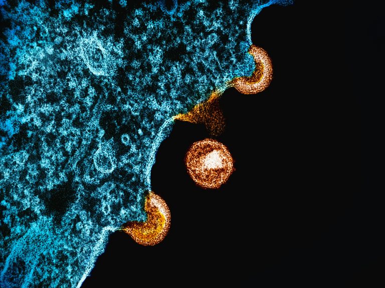 HIV/AIDS: causes, symptoms, prevention, and treatment