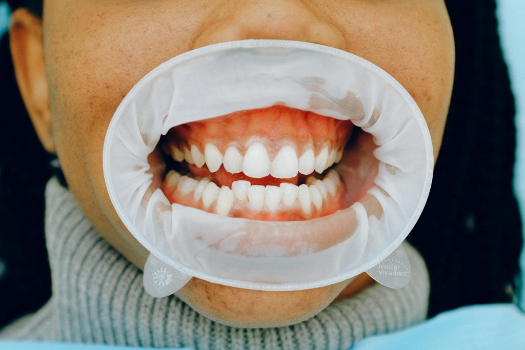 What to Eat and What to Avoid to Prevent Gum Disease 1 What to Eat and What to Avoid to Prevent Gum Disease