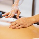12 Natural Remedies to Alleviate Symptoms of Sweet’s Syndrome