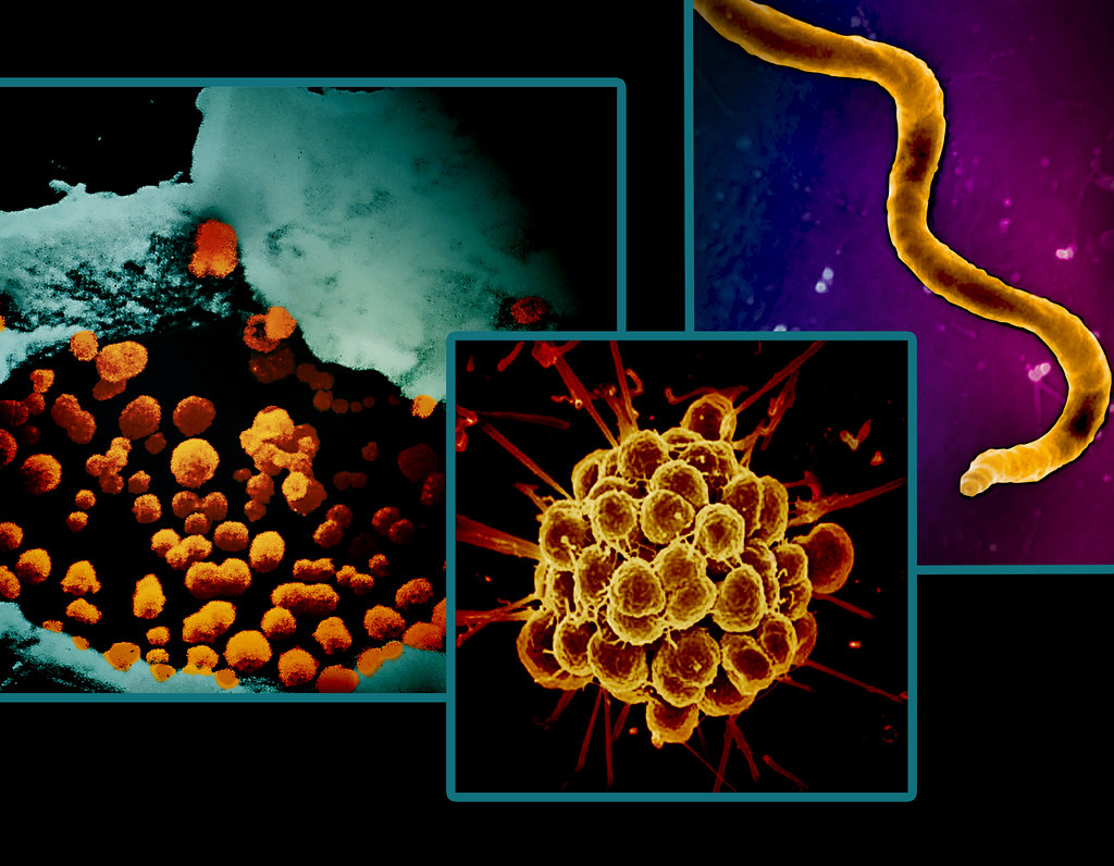 Chlamydia