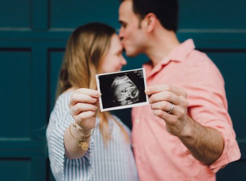 man kissing woman's forehead white holding ultrasound photo