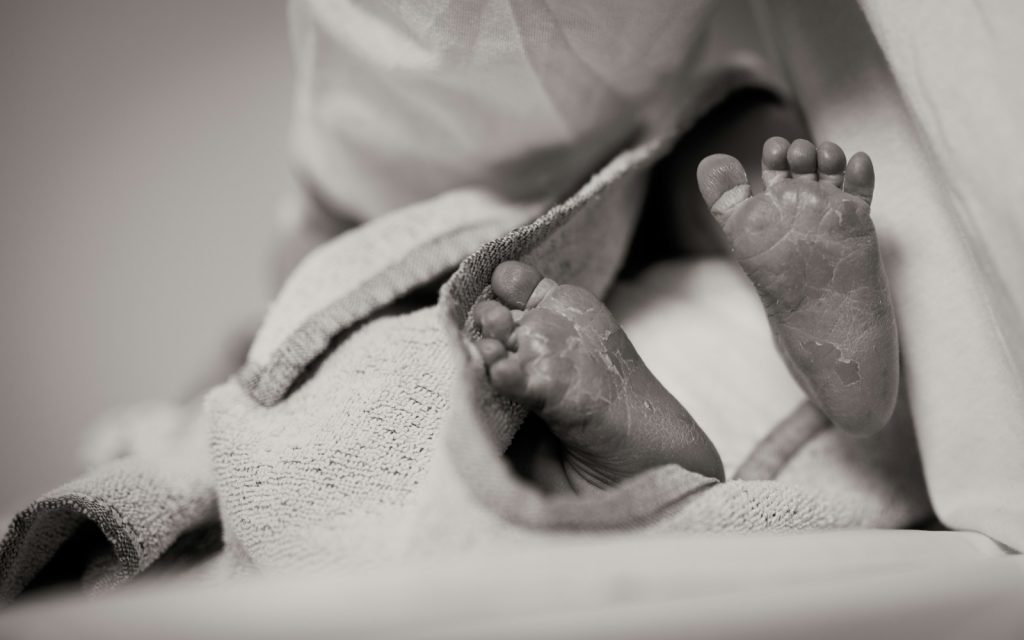 13 Considerations for Babies with Sensitive Skin that All Parents Should Be Aware Of 1 13 Considerations for Babies with Sensitive Skin that All Parents Should Be Aware Of