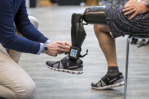 How Do Bionic Limbs Work with Neural Signals?