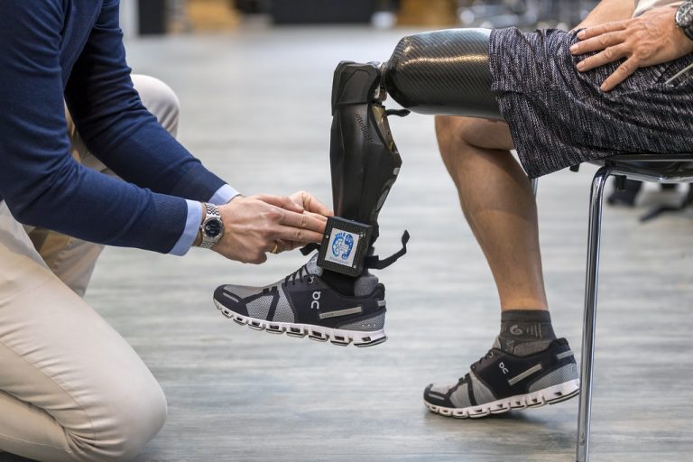 How Do Bionic Limbs Work with Neural Signals?