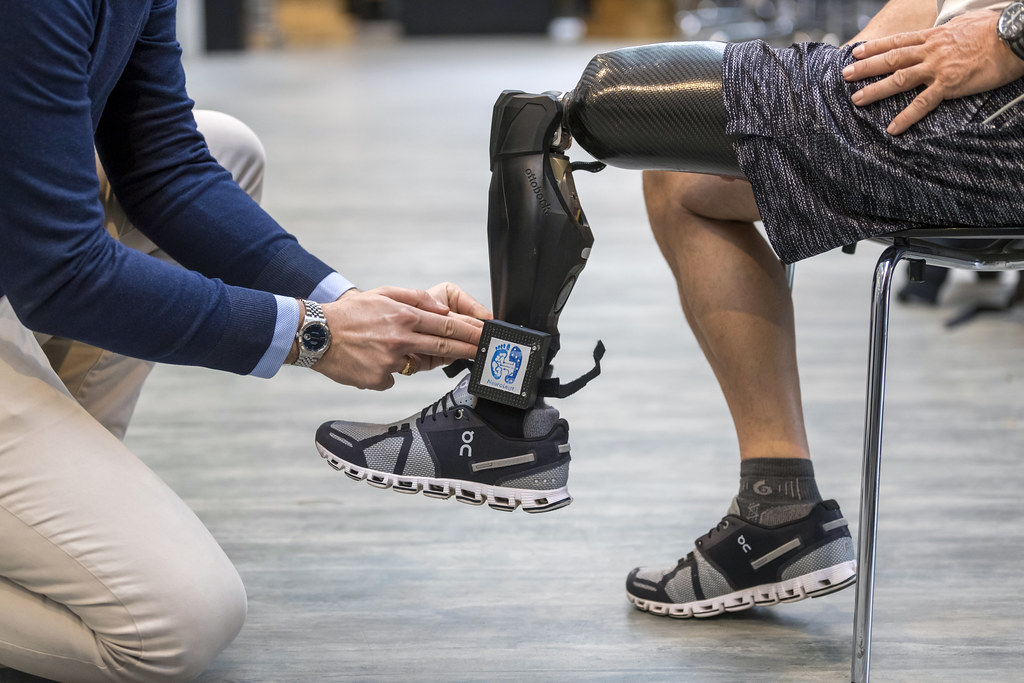 How Do Bionic Limbs Work with Neural Signals?