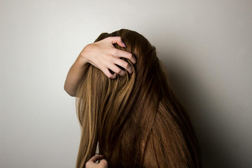 How to Get Rid of Dandruff Naturally: 12 Effective Methods 1 How to Get Rid of Dandruff Naturally: 12 Effective Methods