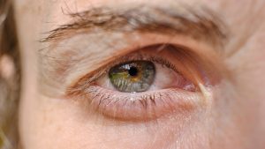 Why Do We Have Reflexes? Examining the Role and Function of Reflex Actions in the Human Body
