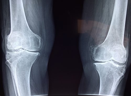 knee, x-ray, medical