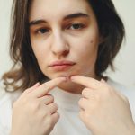 How to Get Rid of Pimples Naturally
