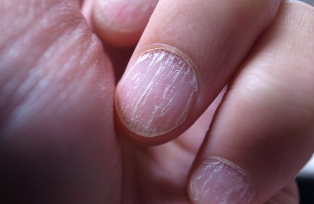 a0813965 0e3a 455e aa2f 8f5329f444cb