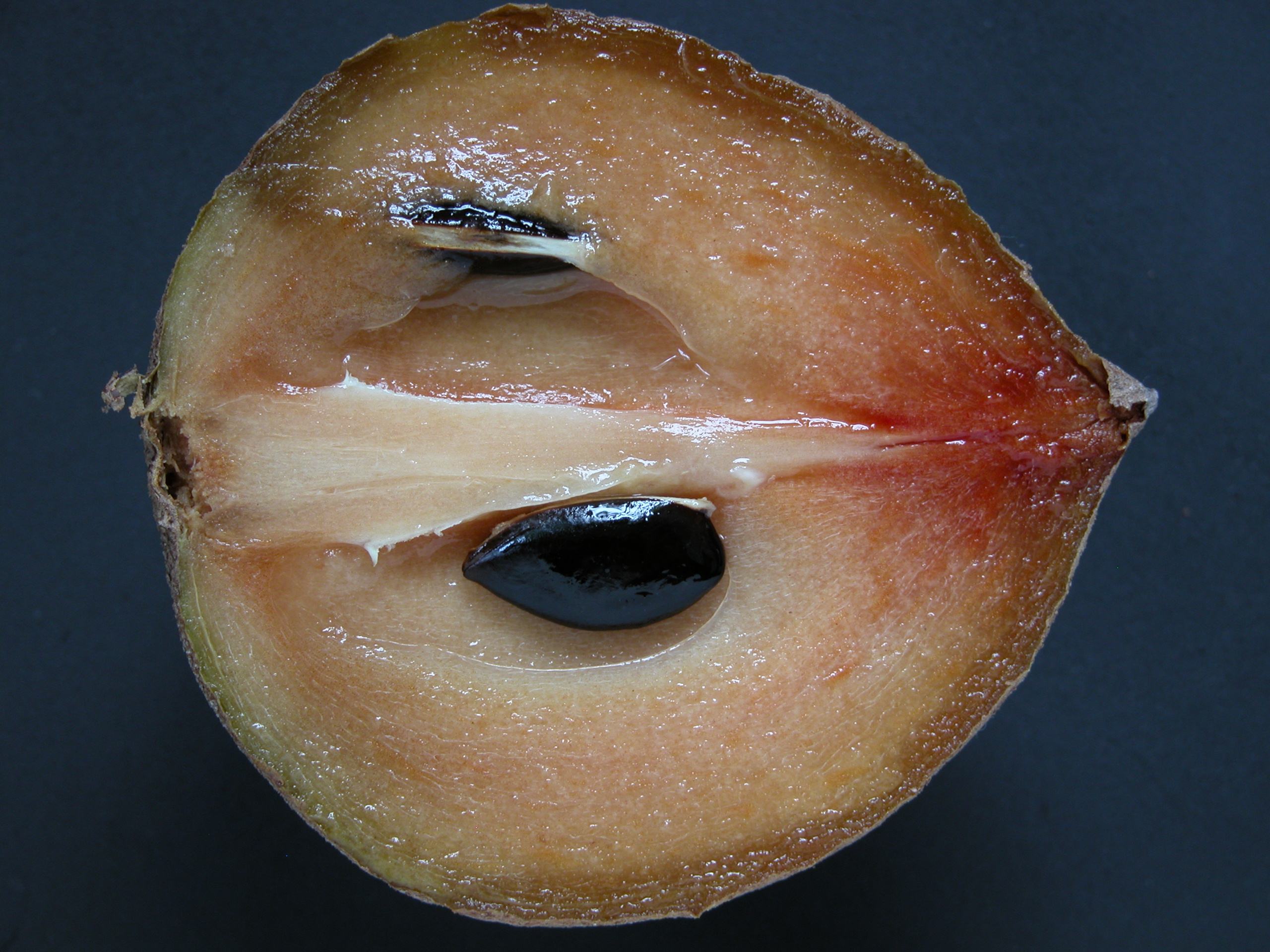 Sapodilla