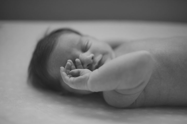 How to Deal with Rare Allergic Reactions in Infants