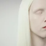 Albinism: Understanding the Science, Challenges, and Myths of a Rare Genetic Condition