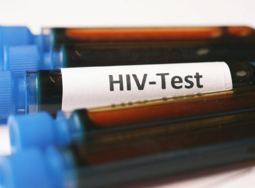HIV