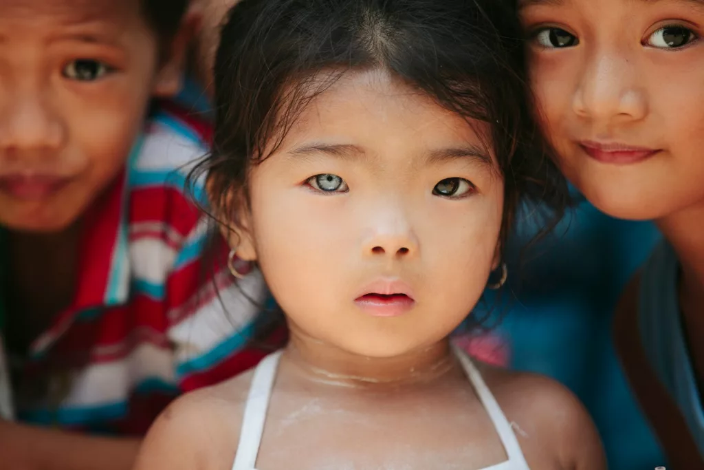 Why Do Some People Have Two Different Eye Colors? Understanding Heterochromia and Its Causes