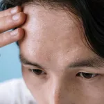 Why Does My Sweat Smell So Bad? Understanding the Causes and Solutions for Body Odor