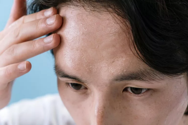 Why Does My Sweat Smell So Bad? Understanding the Causes and Solutions for Body Odor