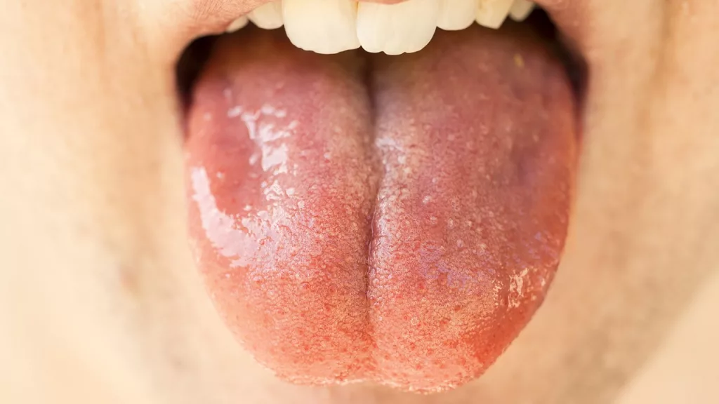 The Vital Role of Saliva: Key to Oral Health and Digestive Success 1 The Vital Role of Saliva: Key to Oral Health and Digestive Success