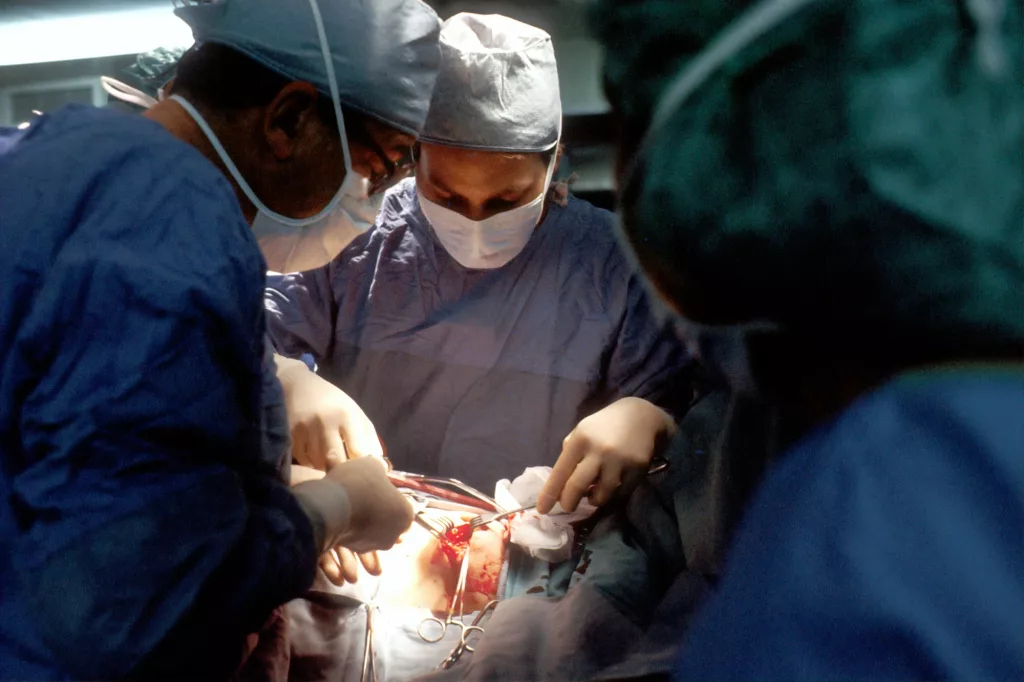 Xenotransplantation: Exploring the Promise and Challenges of Animal-to-Human Organ Transplants