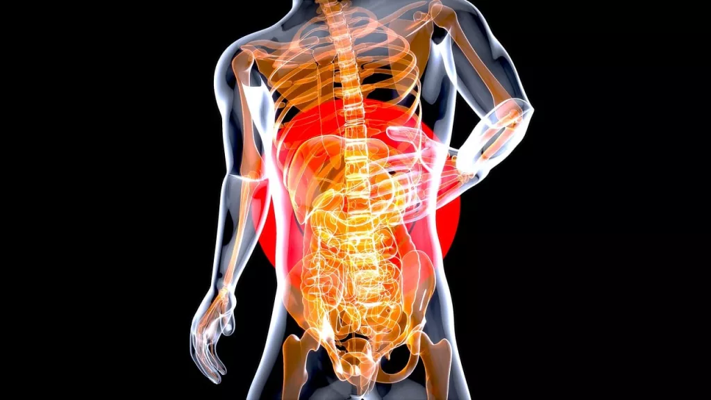 Heartburn Demystified: Causes and Mechanisms of Acid Reflux Explained 1 Heartburn Demystified: Causes and Mechanisms of Acid Reflux Explained