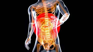 Why Do We Experience Heartburn? Investigating the Causes and Mechanisms of Gastroesophageal Reflux