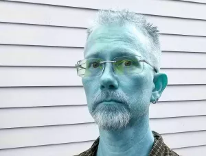 Methemoglobinemia: The Mystery of the Blue Skin Syndrome
