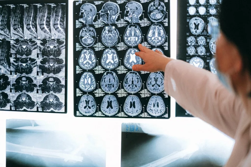 Hyperthymesia: The Superpower of Remembering Every Moment of Your Life 1 Hyperthymesia: The Superpower of Remembering Every Moment of Your Life