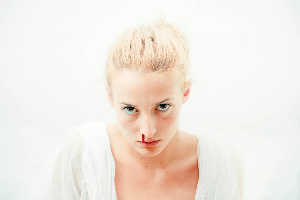 Why Do We Get Nosebleeds? Understanding the Common Causes and Treatments for Epistaxis 1 Why Do We Get Nosebleeds? Understanding the Common Causes and Treatments for Epistaxis
