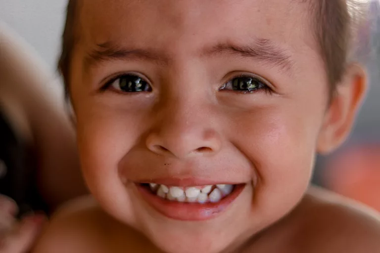 Why Do We Have Baby Teeth? Exploring the Developmental Role and Purpose of Deciduous Teeth
