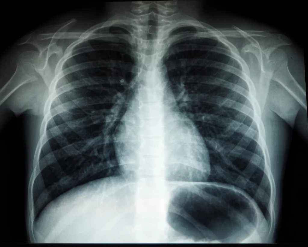 What’s the Difference Between Radiography and Sonography? 1 What’s the Difference Between Radiography and Sonography?