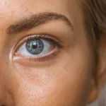 Why Is My Skin So Oily?