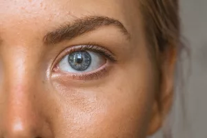 Why Is My Skin So Oily?